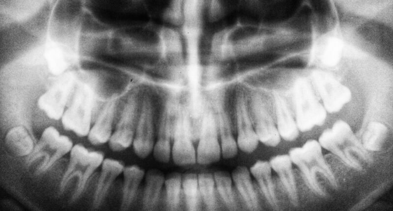 Dentes no Mundo: Descubra os Países com os Piores e Melhores Sorrisos!