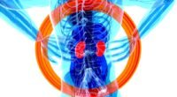 Endometriose: Dor Intensa Pode Indicar Doença Complexa e Atingir Outros Órgãos