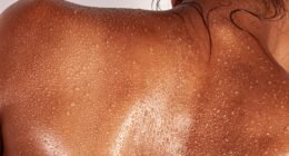 O Erro no Banho Que Está Deixando Sua Pele Mais Seca: Descubra Como Evitar!