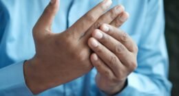 Sarampo: Sintomas Preocupantes e Como se Proteger da Doença Altamente Contagiosa